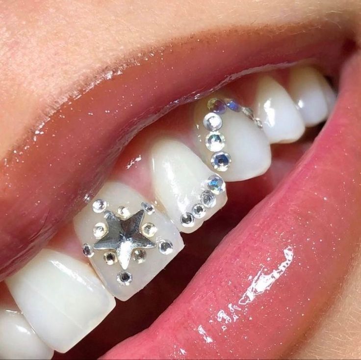 Star tooth gem on sale